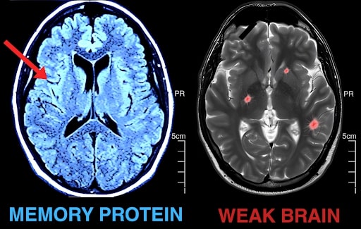 Brain scan comparison